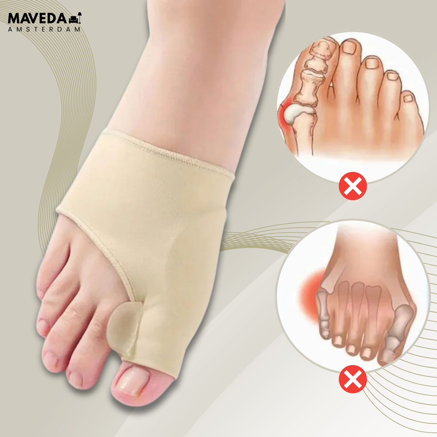 OrthoToe – Immediate Pain Relief from Hallux Valgus