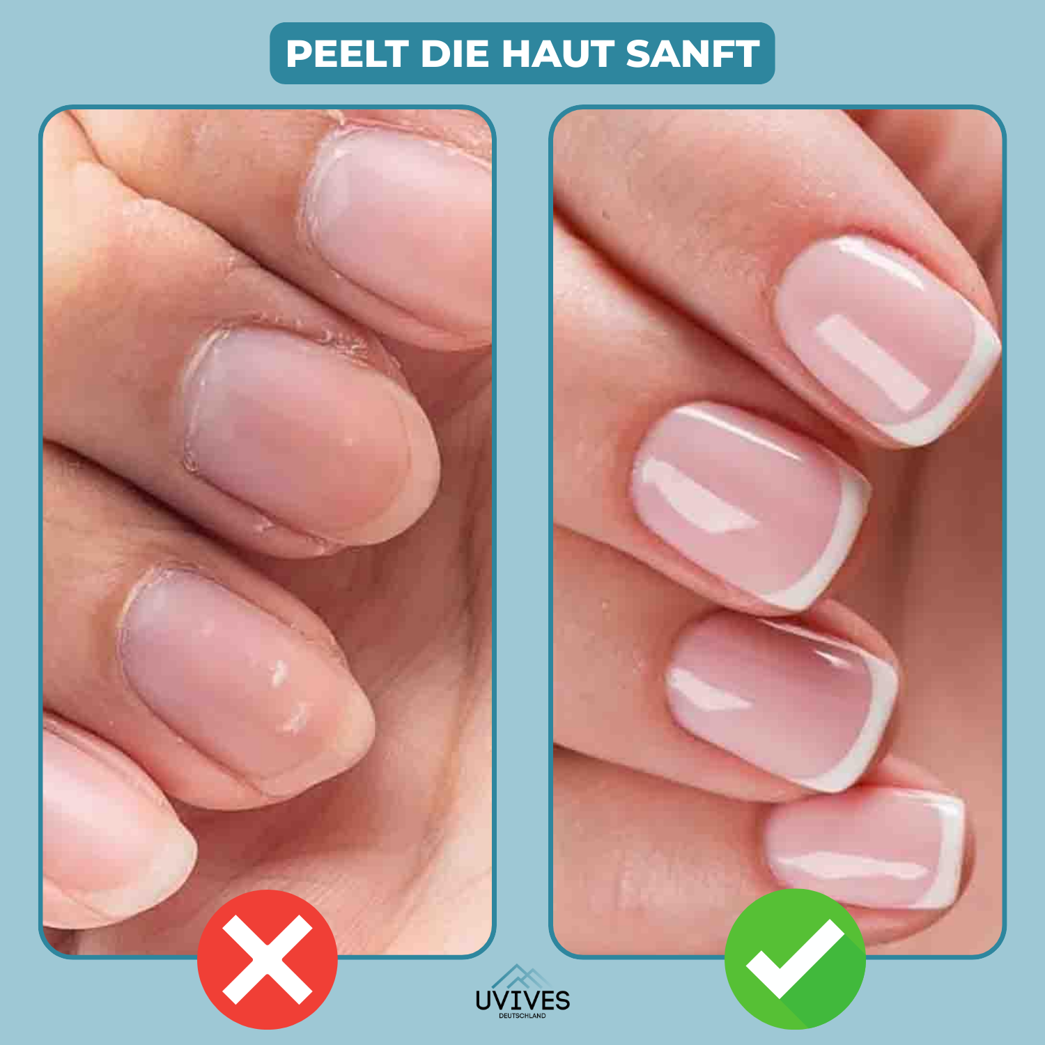 1+1 FREE | GlossBloom – Healthy, Beautiful Nails in Seconds!