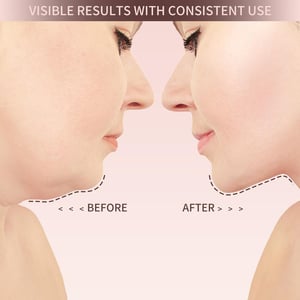 VitaLift – Naturally Lift Your Facial Contours