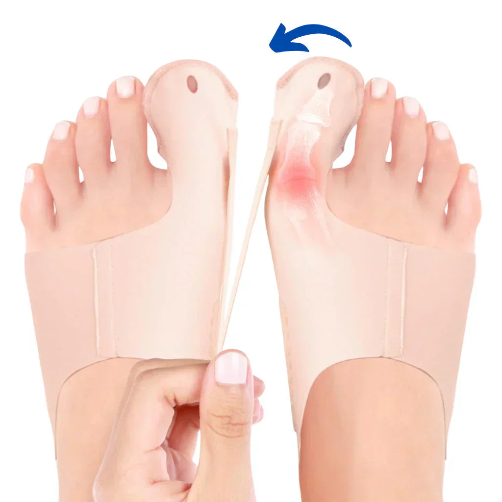OrthoFlex – Pain-Free Steps with Hallux Valgus!