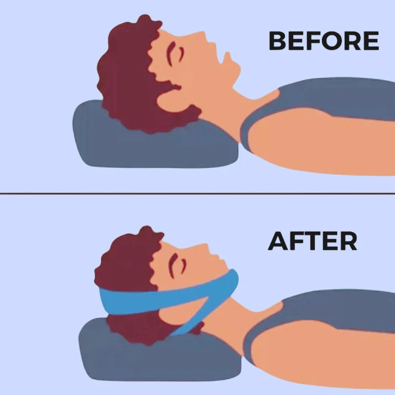 SilentFit – The Comfortable Chin Strap for Peaceful Nights