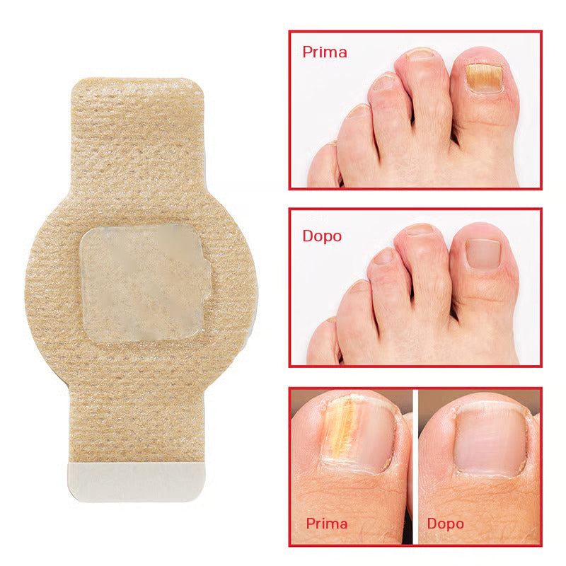 FungoStop – Restore Healthy Nails While You Sleep!