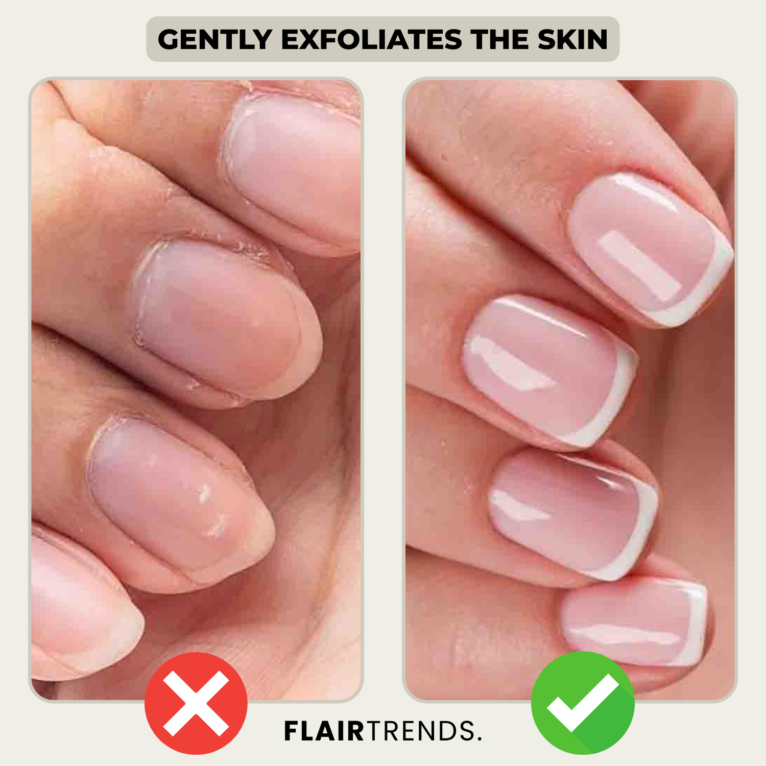 1+1 FREE | GlossBloom – Healthy, Beautiful Nails in Seconds!