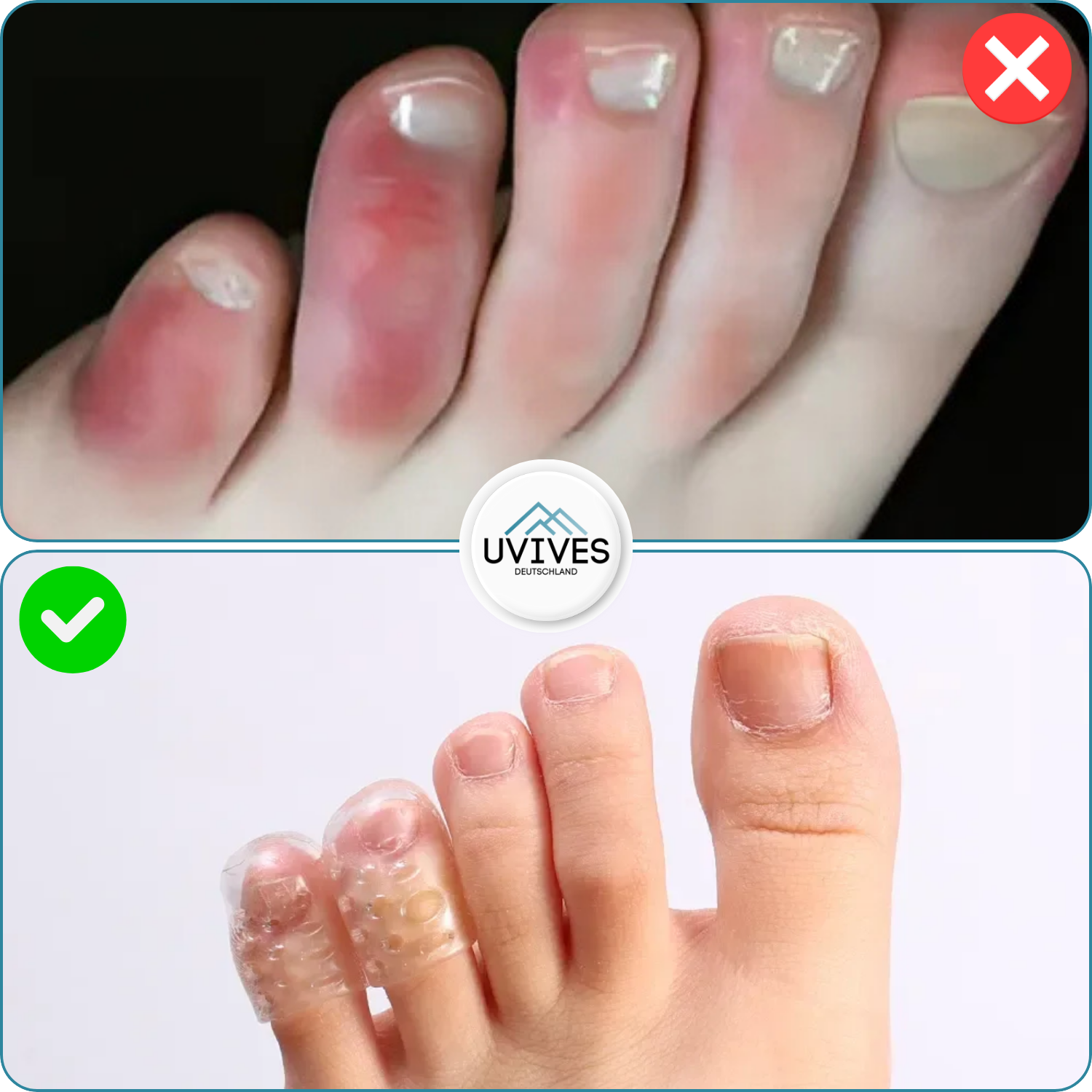 5+5 FREE | SafeWalk – No More Sore Feet!