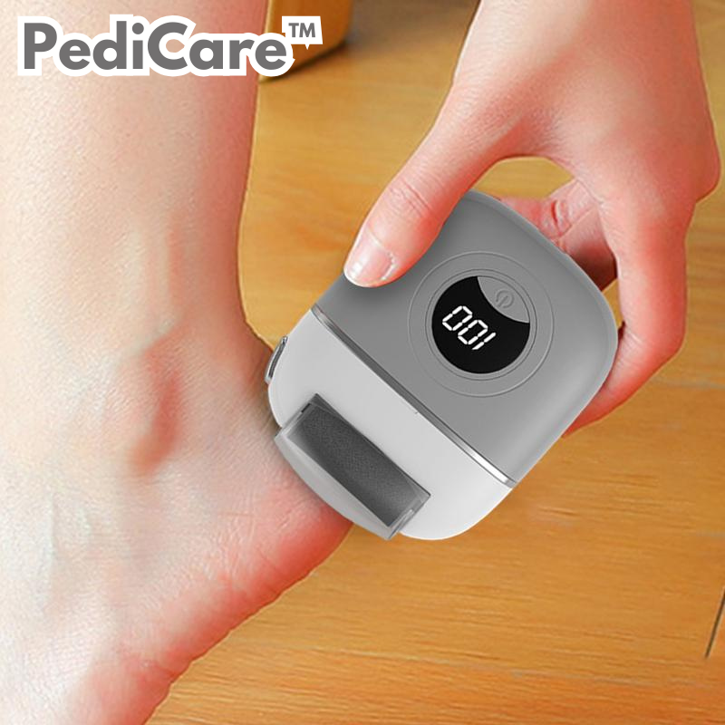 SmoothEase – Silky Soft Feet in Minutes!