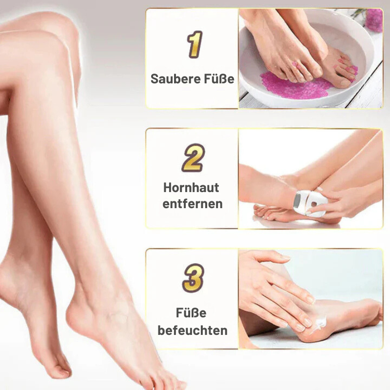SmoothEase – Silky Soft Feet in Minutes!