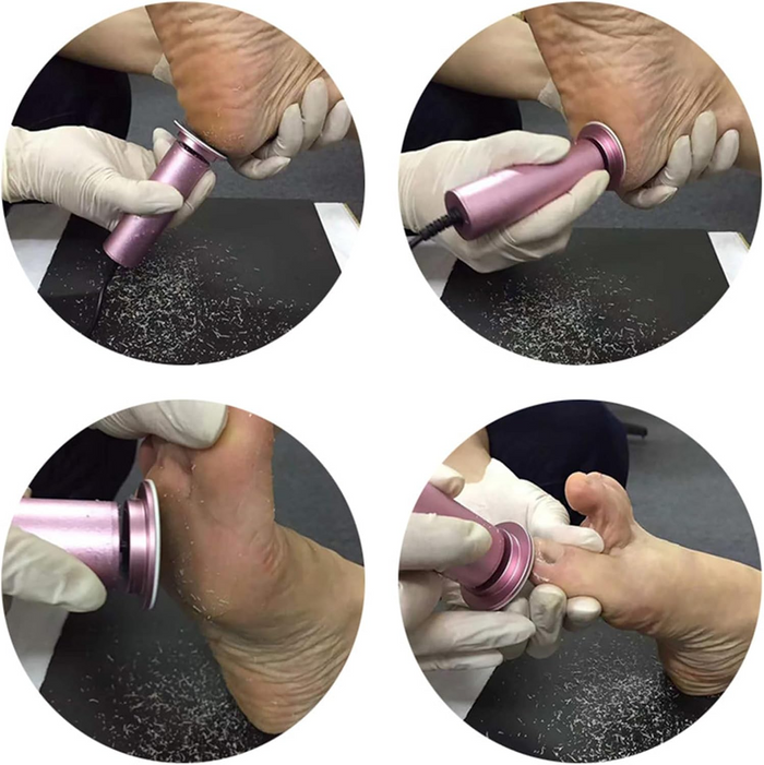 FootSmooth – Silky soft feet in just minutes!