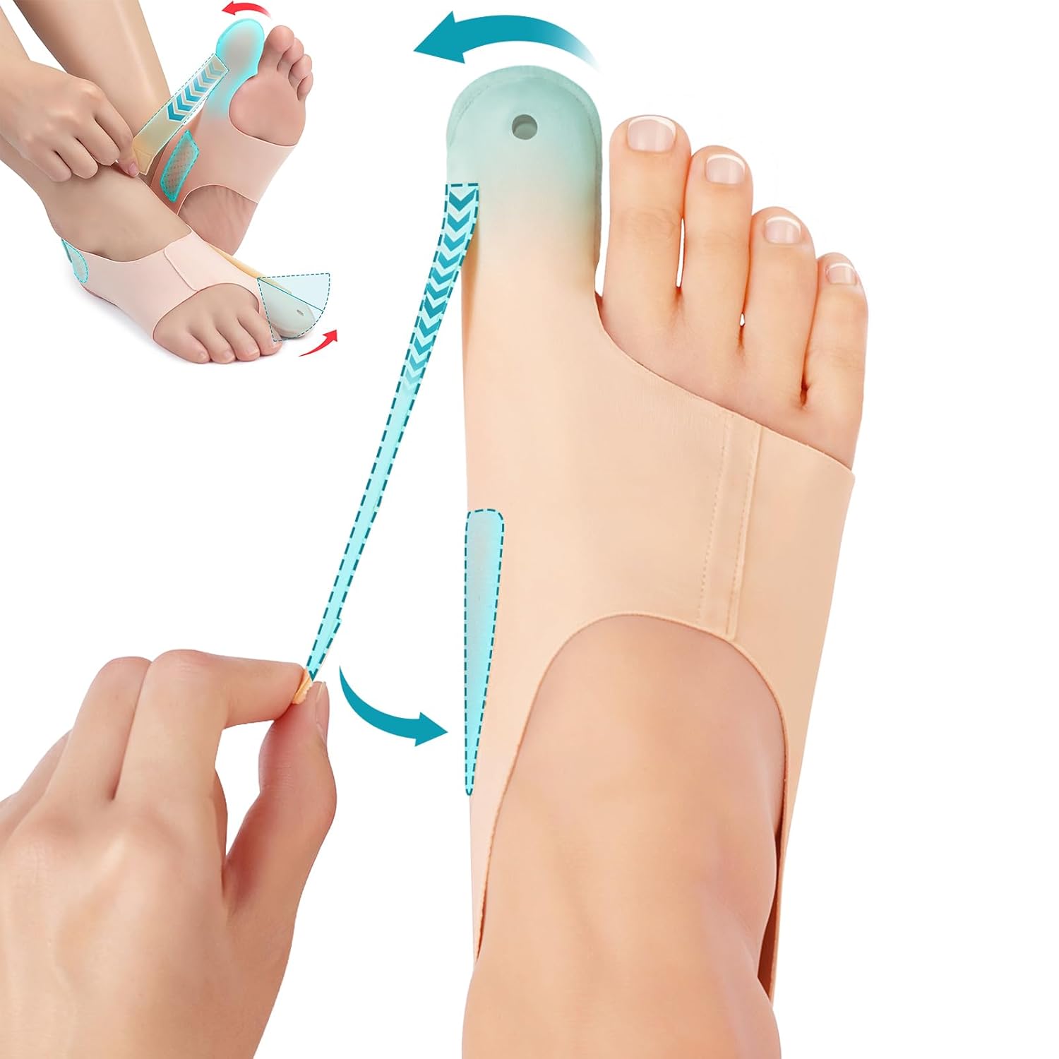 OrthoFlex – Pain-Free Steps with Hallux Valgus!