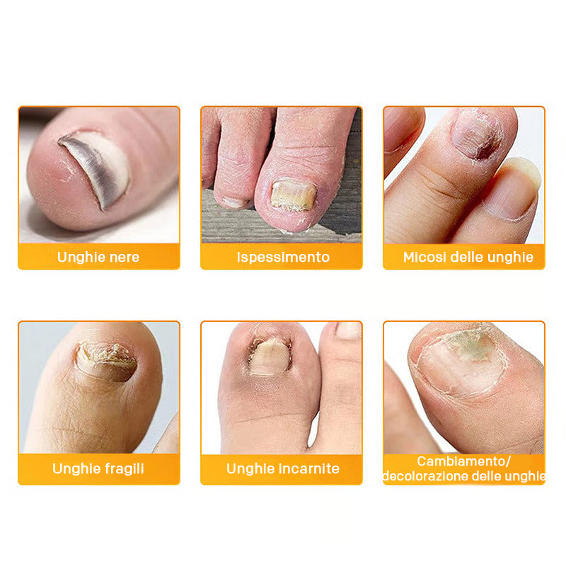 FungoStop – Restore Healthy Nails While You Sleep!