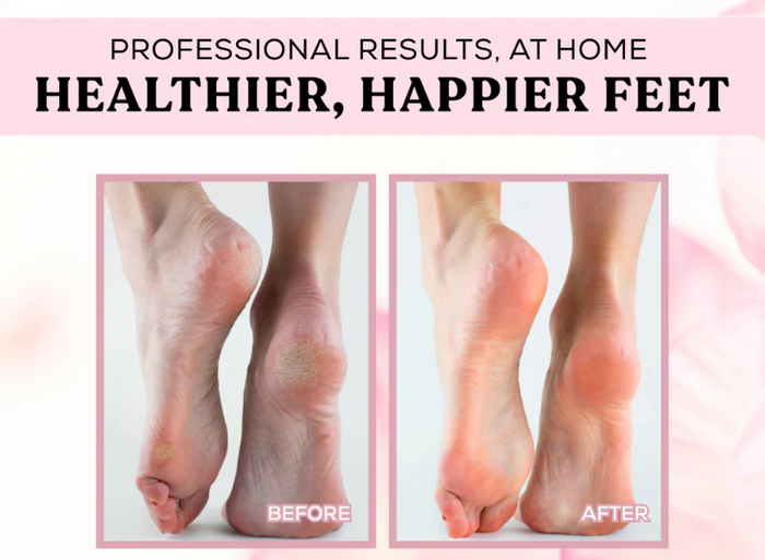 FootSmooth – Silky soft feet in just minutes!