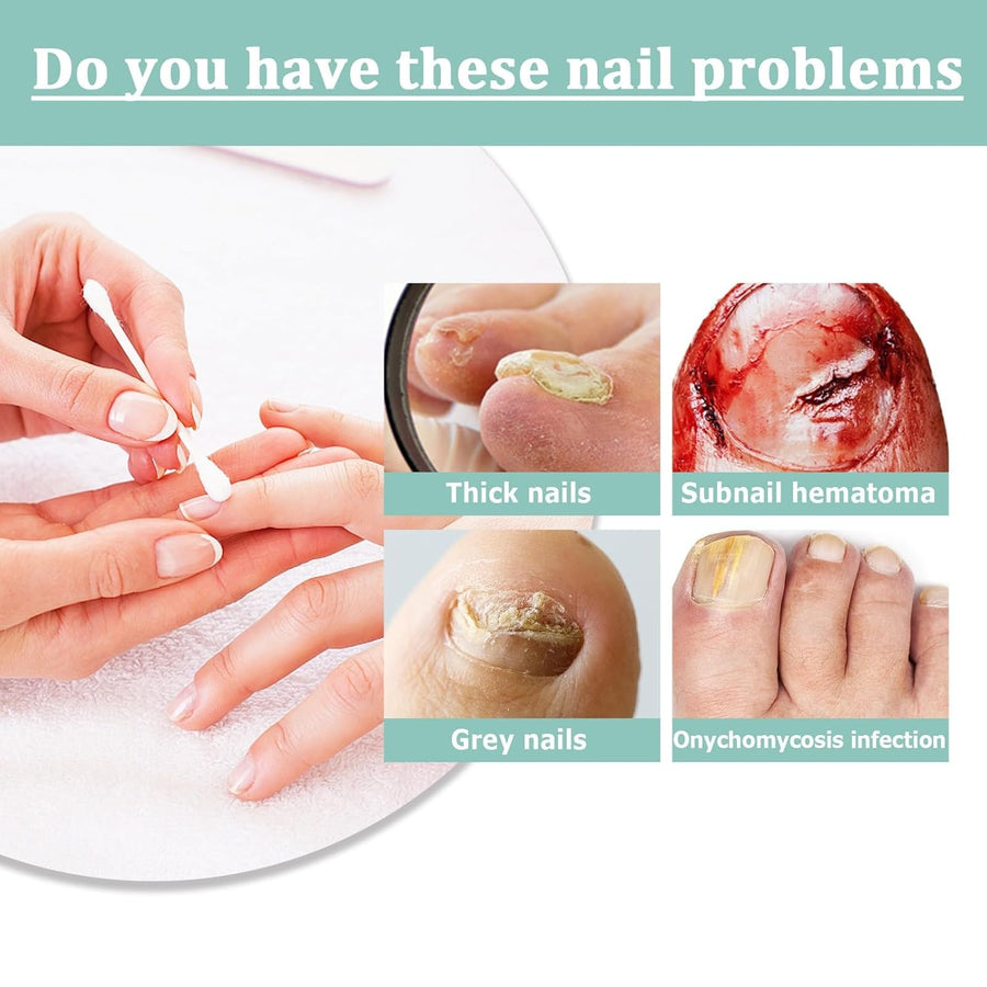 1+1 FREE | NailBloom – Say Goodbye to Brittle Nails Forever