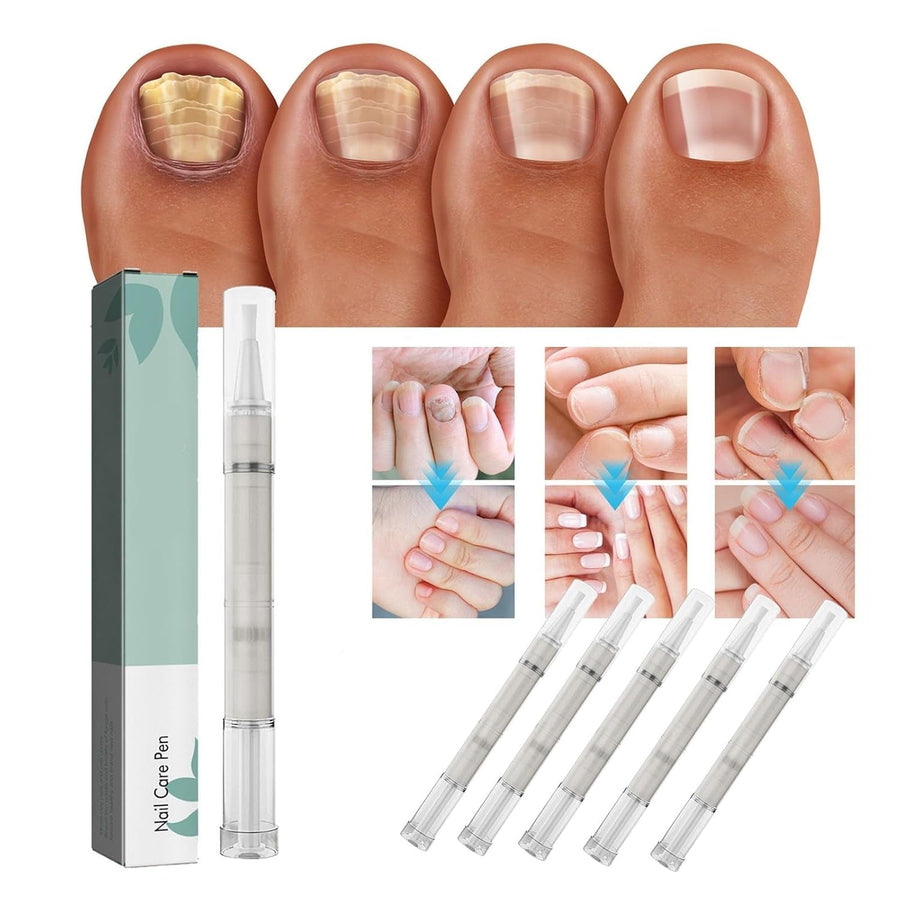 1+1 FREE | NailBloom – Say Goodbye to Brittle Nails Forever