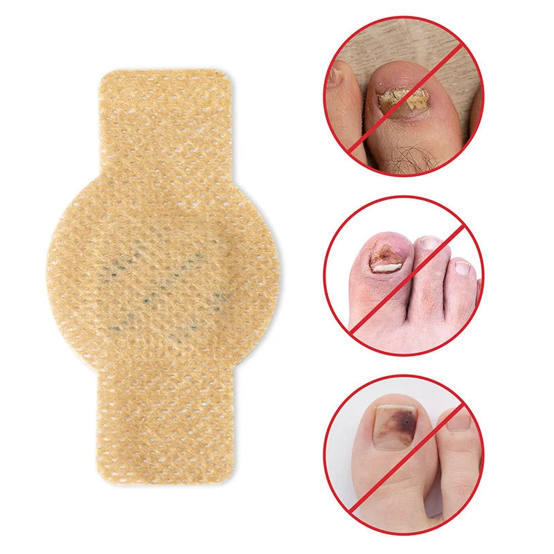 FungoStop – Restore Healthy Nails While You Sleep!