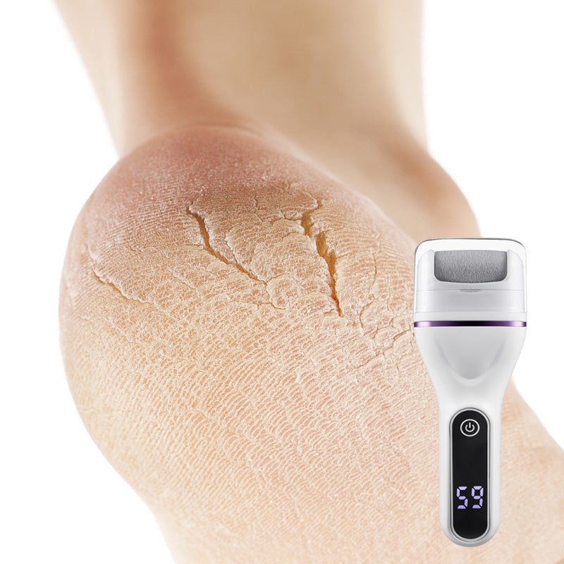 SoftStep Pro – Smooth Feet Without Salon Visits